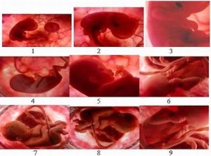 embryo