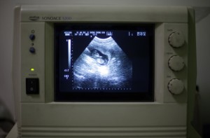 aborto-ecografia