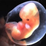 14109_t_feto-embrione-grembo-aborto